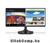 LG 25 25UM65-P LED IPS 21:9 Ultrawide DVI HDMI monitor LG 25 25UM65-P LED IPS 21:9 Ultrawide DVI HDMI monitor