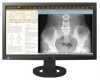 Eizo monitor MS230W 23  DICOM-Prester, �r, v�s�rl�s adat-lap
